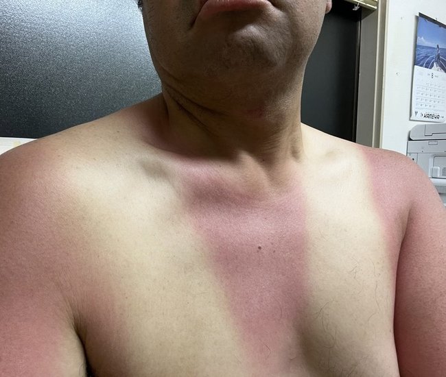 紅白の横断幕のように焼ける