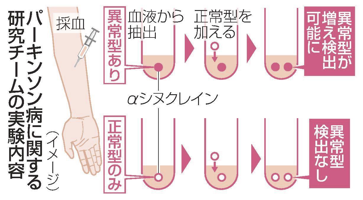 MRI を使用して早期発症パーキンソン病を検出するにはどうすればよいですか?