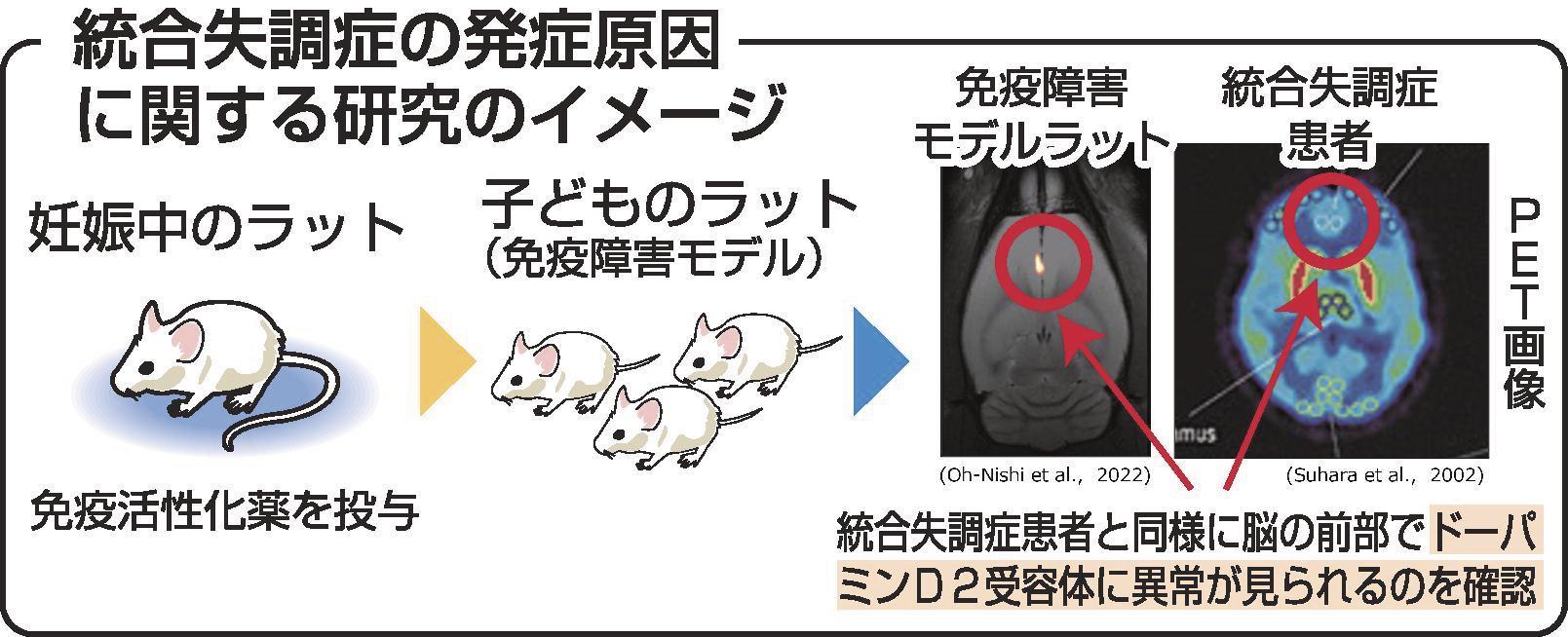 統合失調症の原因は何ですか?