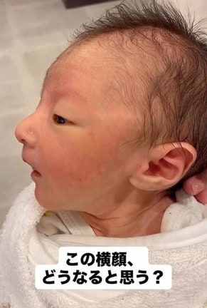 産院の看護師さんからも「高いですね」と声をかけられたという鼻高ベビーの息子さん。