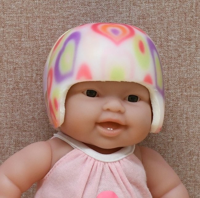 乳児の頭の形を矯正するヘルメット
